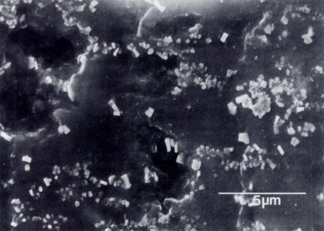 颈长肌腱炎影像表现,三头肌钙化性肌腱炎治疗