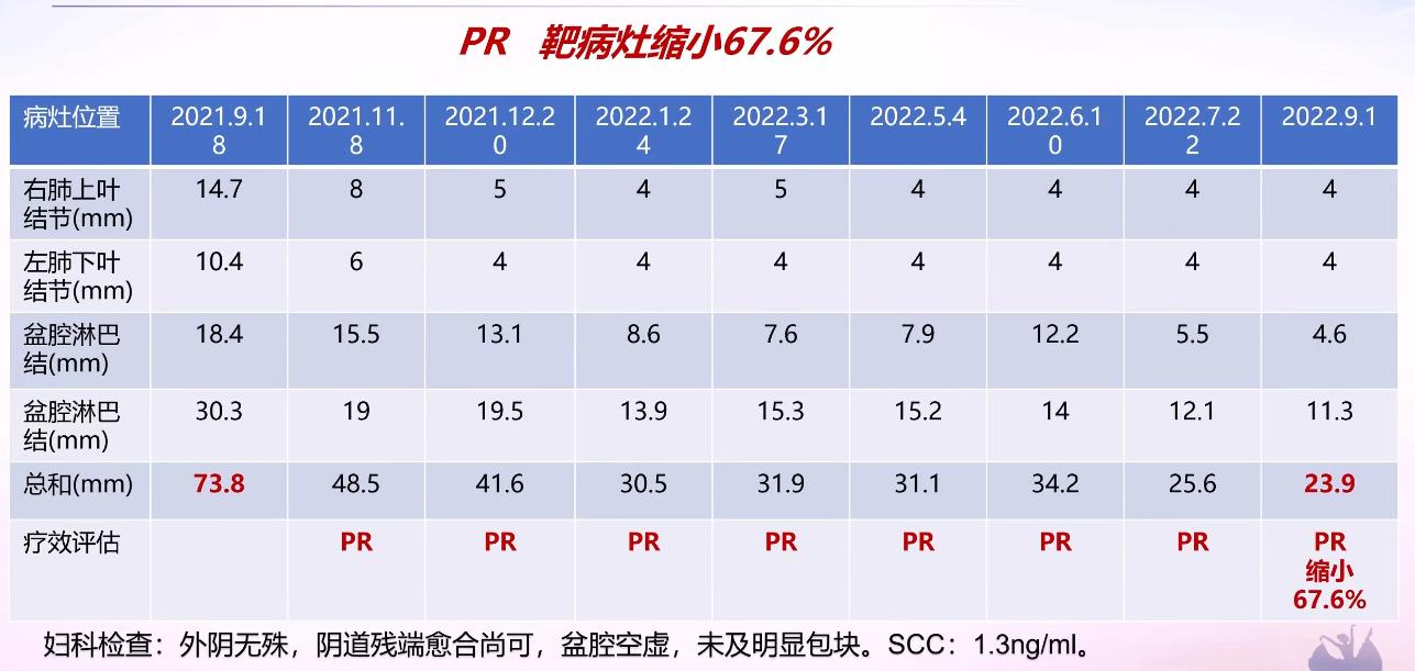 卡度尼利单抗宫颈癌晚期成功案例,宫颈癌复发卡度尼利单抗