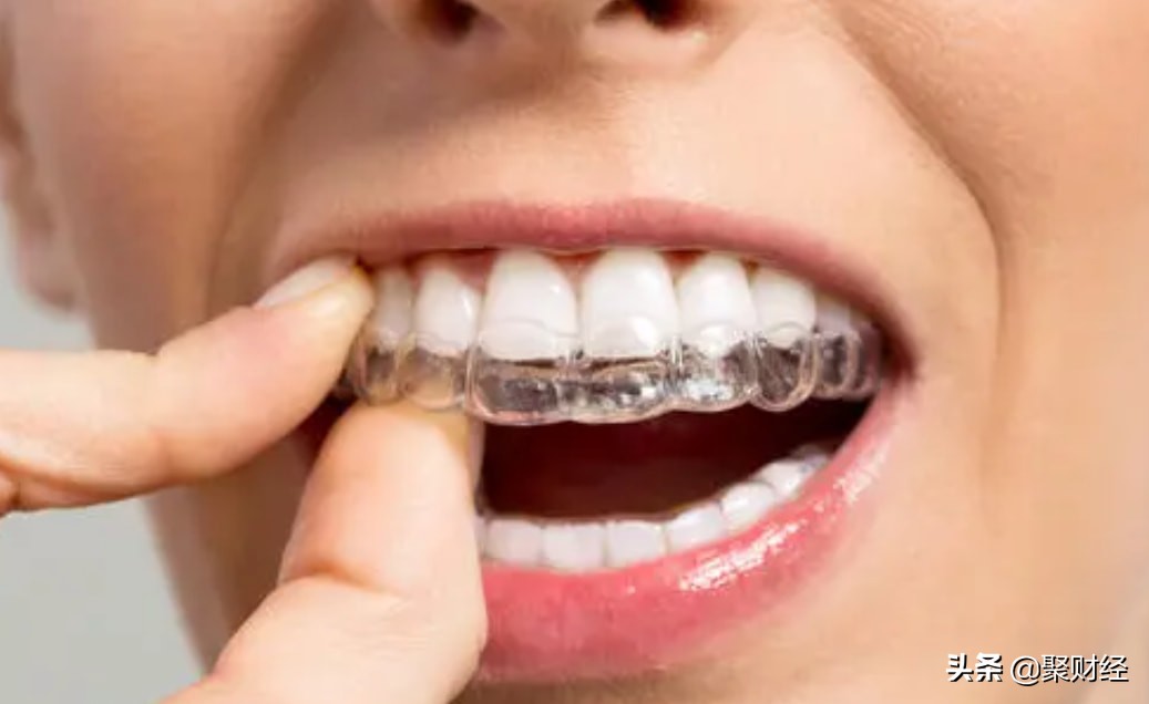 成本1万卖出去4万毛利率是多少,一年毛利300万销售费用多少