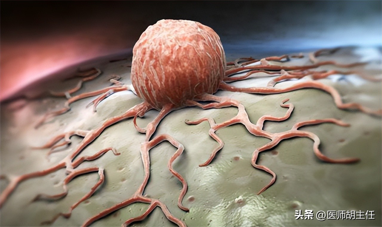 体检肝部囊肿最大2.8怎么办,体检发现肝囊肿肾囊肿