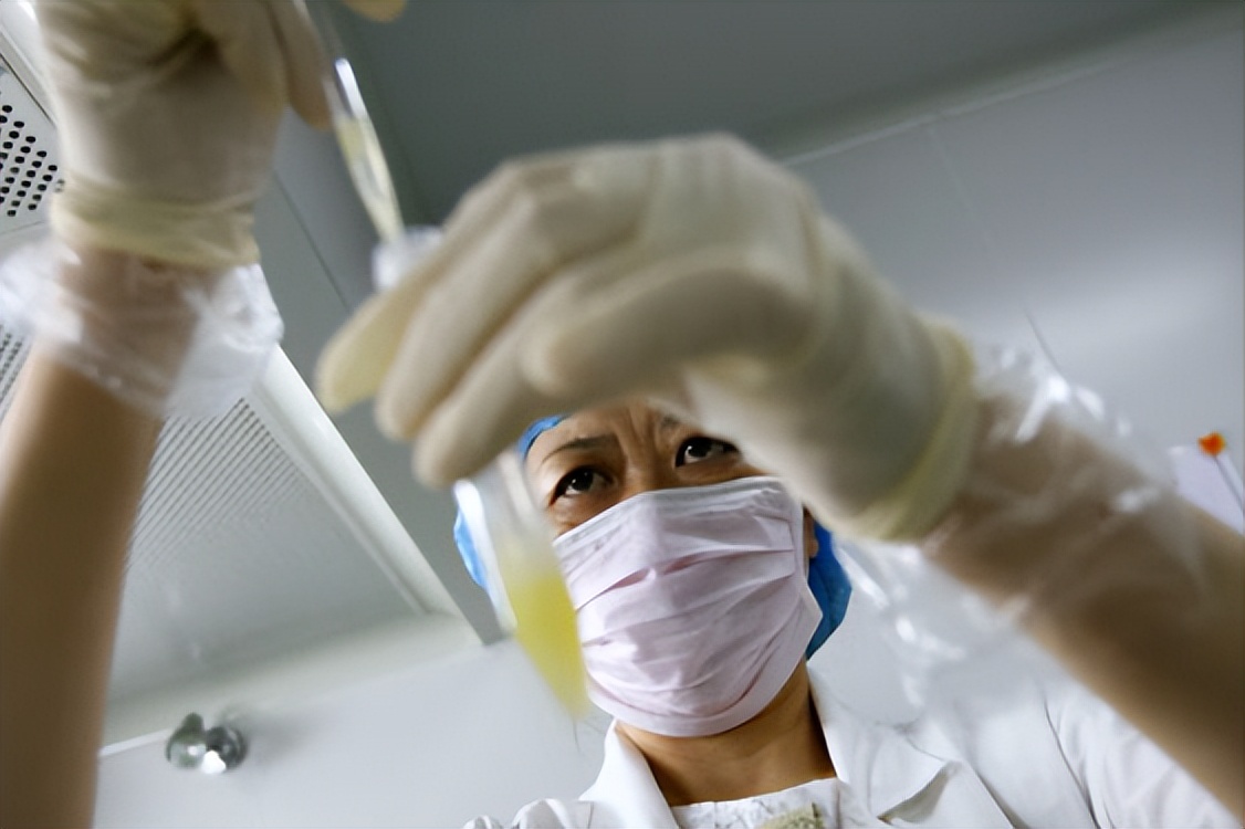 精子变黄什么原因引起的,精子变黄的病因