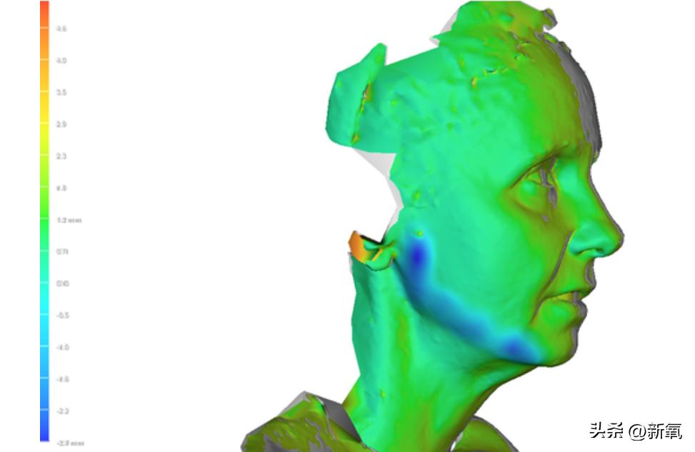 烧到40度会变傻吗,烧到40度要打点滴吗