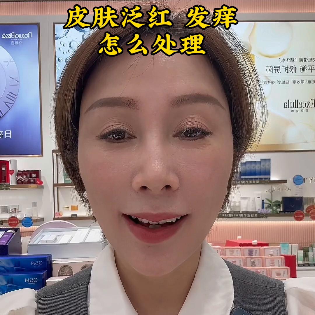 皮肤泛红发痒怎么办,儿童春季皮肤过敏泛红发痒小妙招