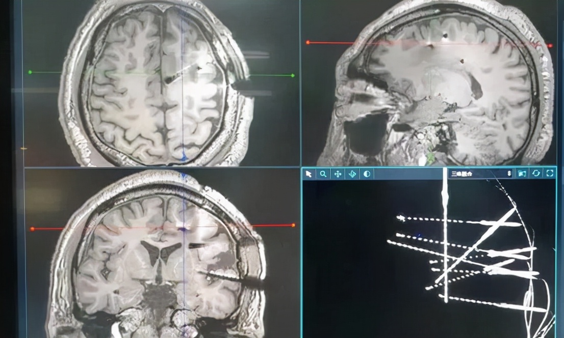 鐢╝i瑙e喅鐥呭巻璐ㄦ帶闅鹃,鐢╝i杩涜鍖荤枟璇婃柇