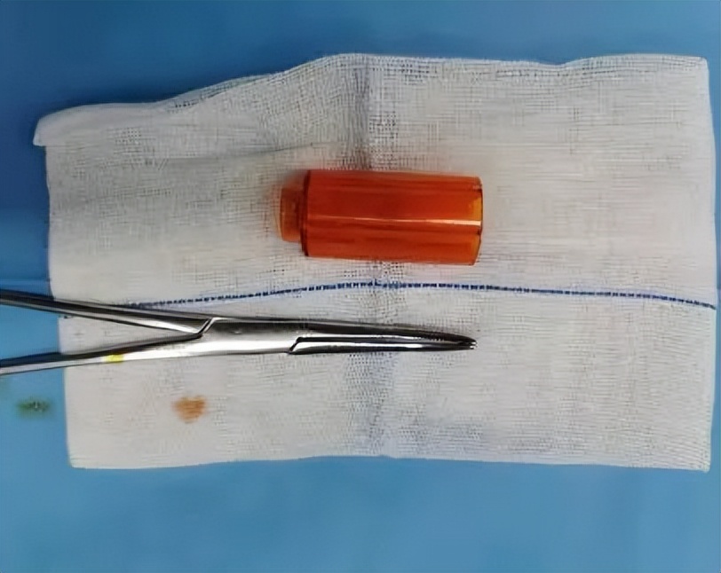 5岁宝宝裤子有血,小孩裤头有褐色分泌物是什么原因