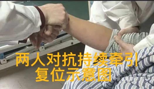 老年人腕部骨折手法复位石膏固定治疗方法指导