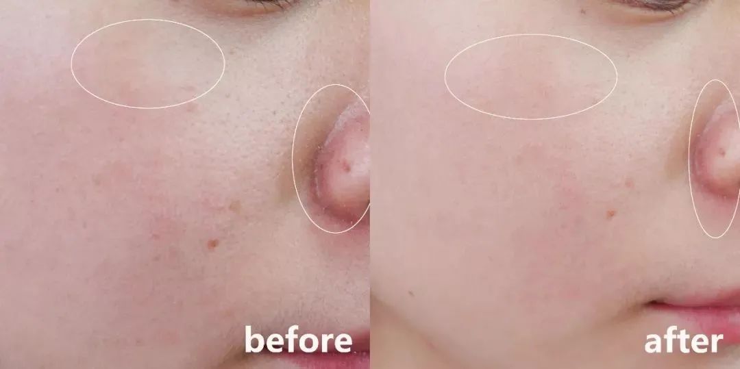 雪花秀祛黄提亮水乳推荐,韩国雪花秀润燥精华水乳7件套