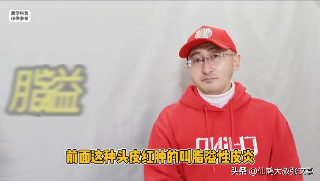 皮肤科医生讲头皮屑多怎么治,头皮屑的快速应急方法