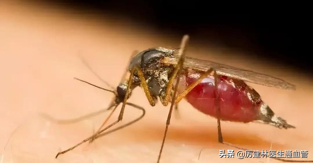 红霉素软膏和红霉素眼膏有何区别,红霉素软膏和红霉素眼膏具体区别