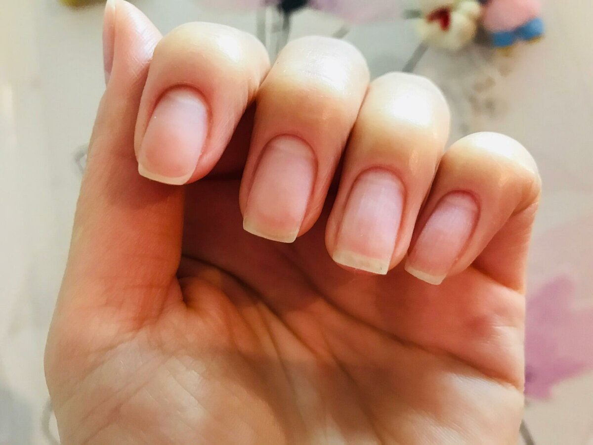 指甲渐变有条纹怎么解决,指甲薄有竖纹容易开裂不易长出来