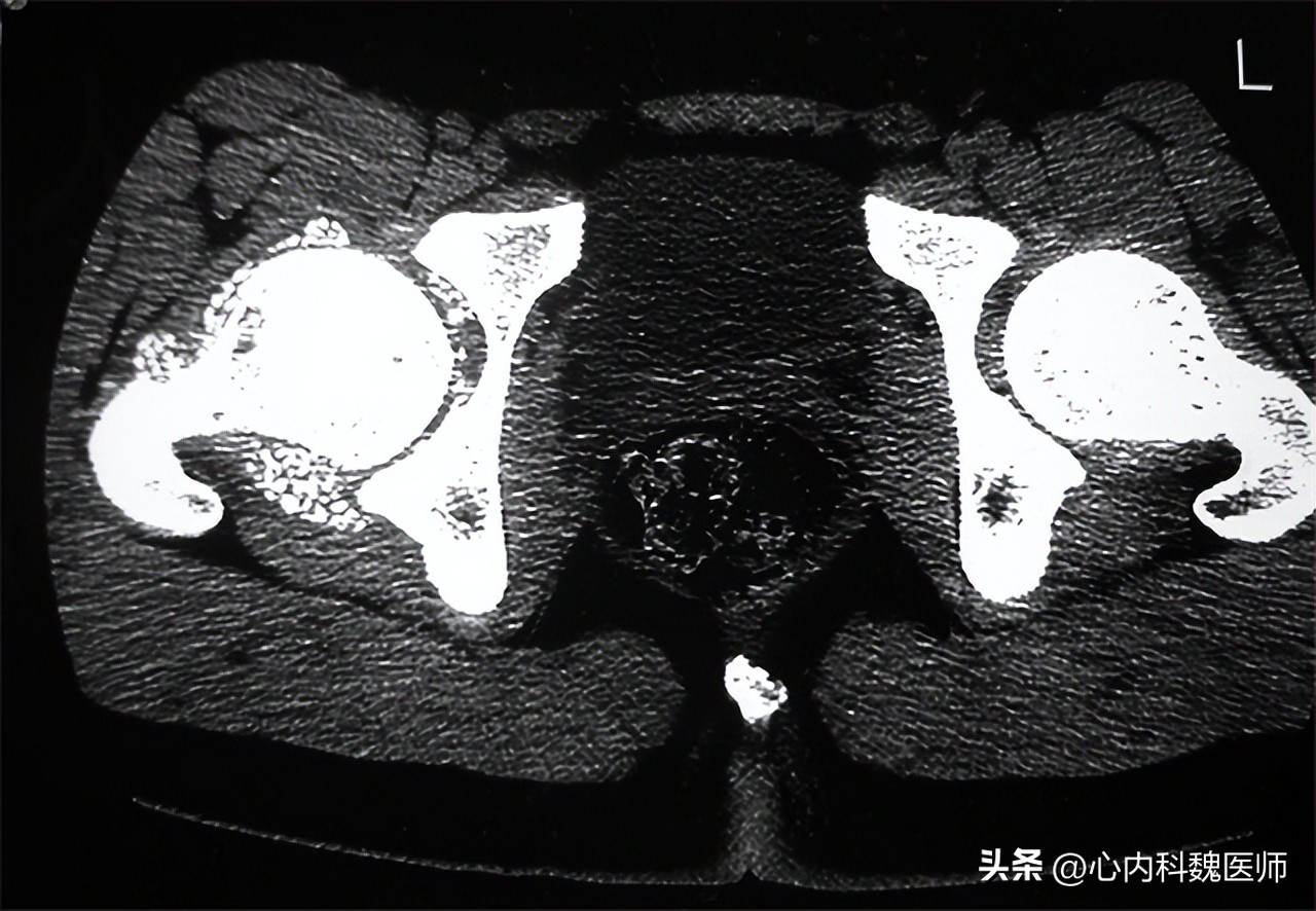 身体有病胯骨知道,身体有什么问题必须去医院看