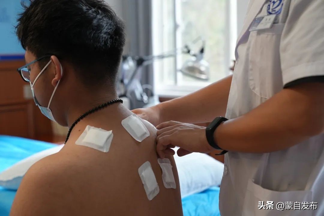 今日入伏三伏贴,入伏贴艾灸贴