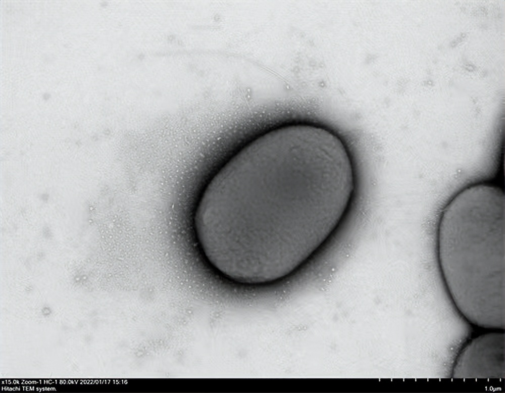 华西医院微生物,四川大学华西医院感染科