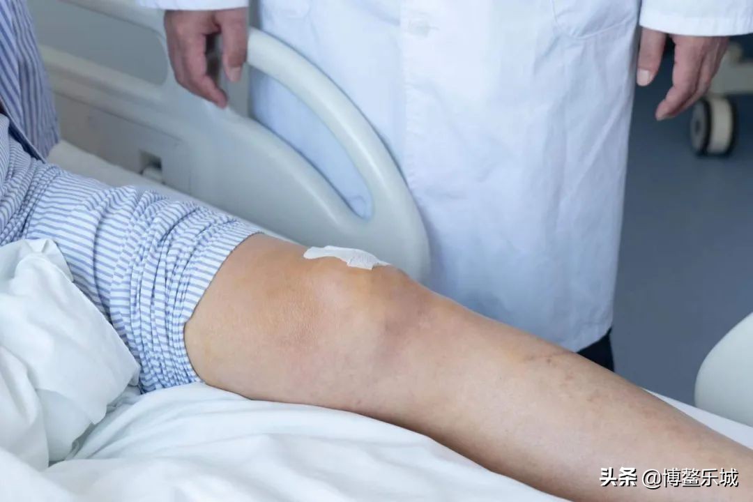 骨性关节炎新突破,治疗骨性关节炎新技术