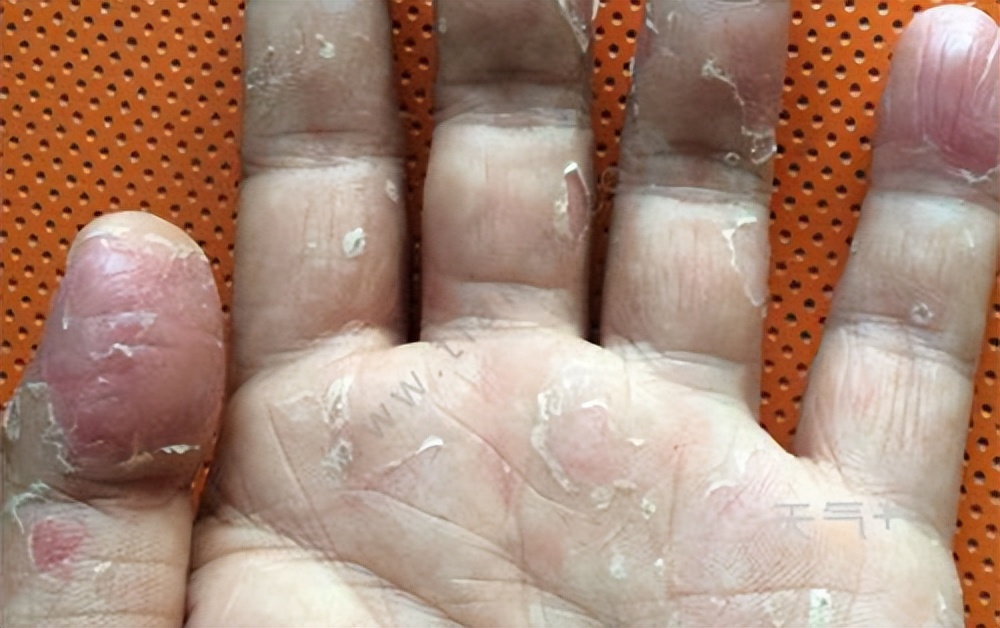 洗洁精是害人精这种说法对吗,洗洁精残留致癌真相揭晓