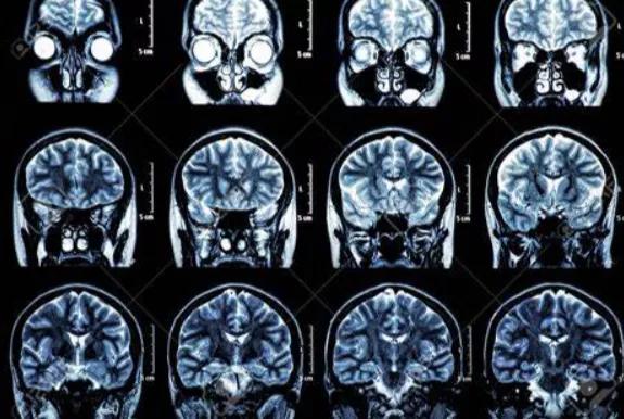 mr技术实例,mr技术的新闻