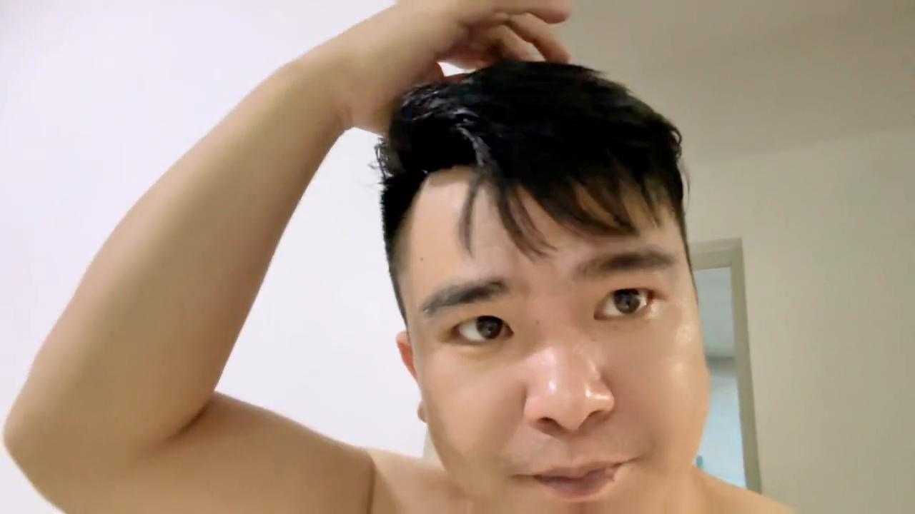 戴了假发后怎么老是掉头发,戴了两年假发头发秃了