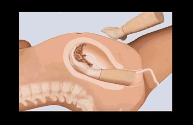 女人生孩子全过程曝光（漫画）