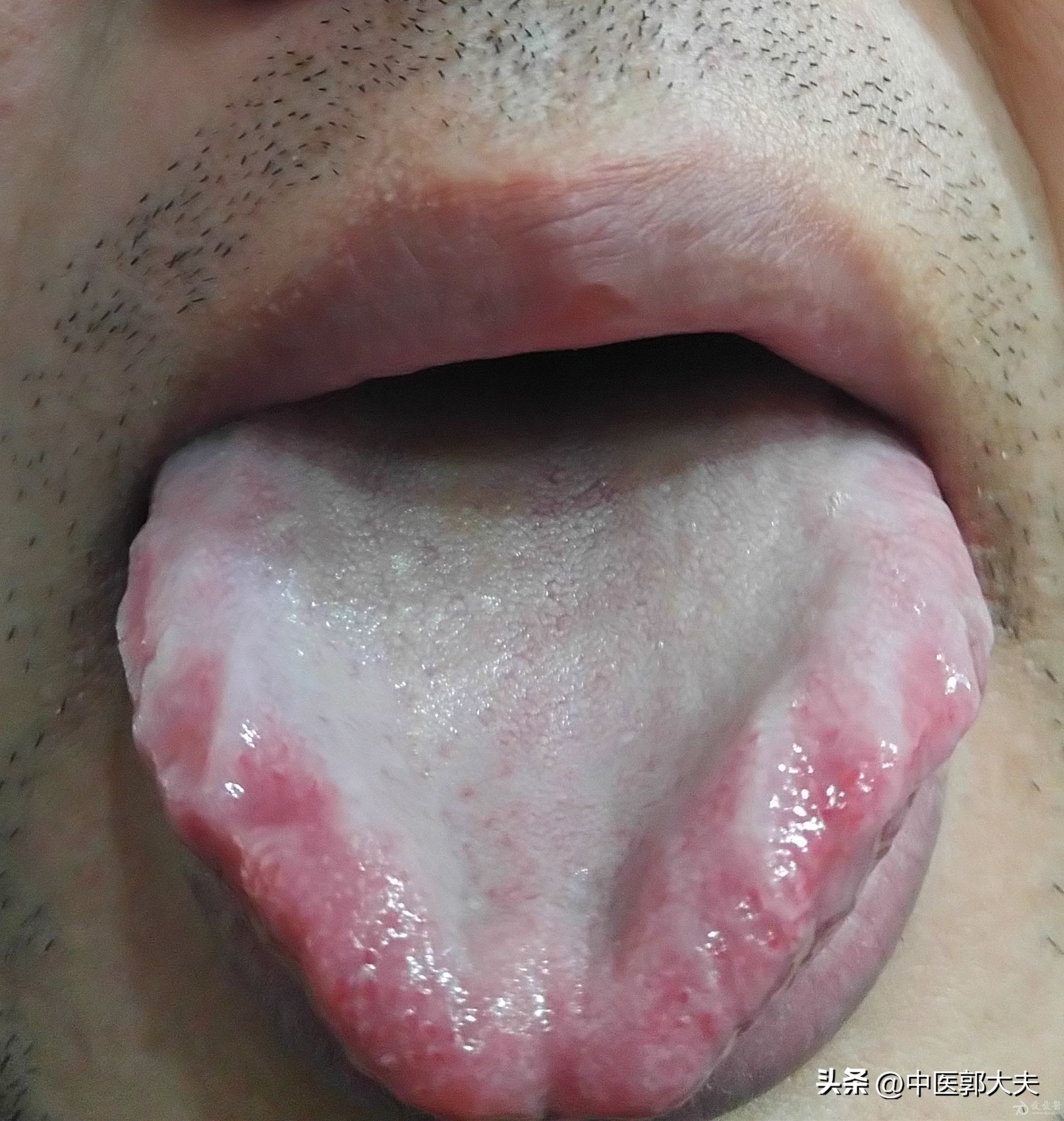 气虚血虚脸色黄肾亏虚,肾虚的脸色和脾虚的脸色