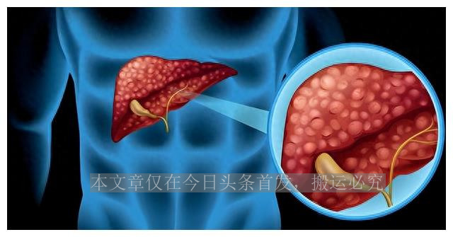 提醒：3类牙膏或有潜在致癌风险，不建议购买！看看你家有吗？