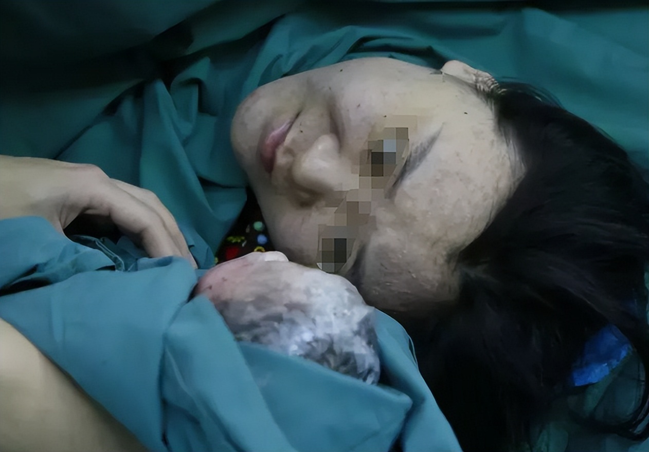 女人无子宫无卵巢,51岁女子试管生下4胞胎