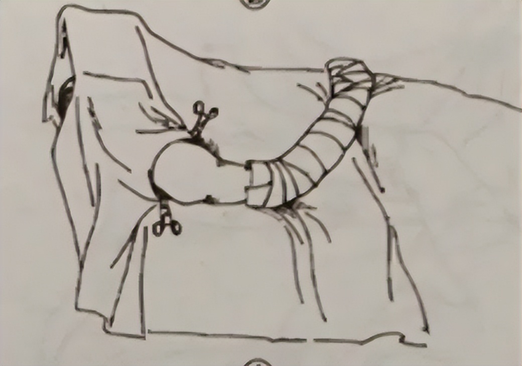 外科手术消毒、铺巾操作，做好这几个细节事半功倍