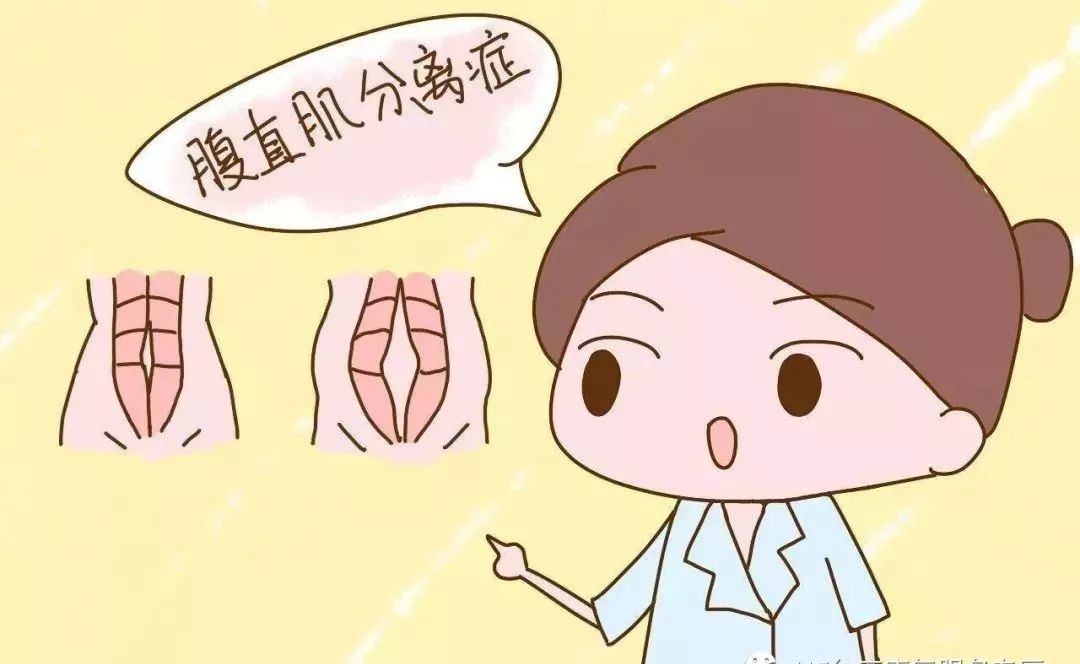 腹直肌分离最有效的恢复方法,产妇腹直肌分离调整