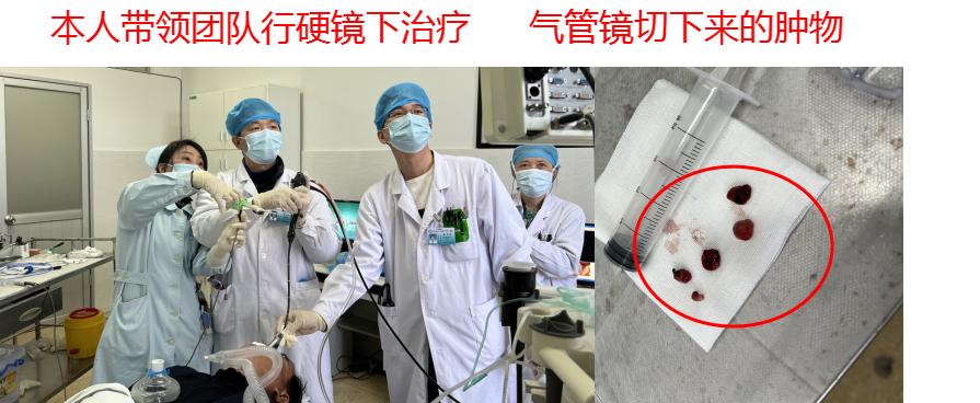 气管镜下肿瘤怎么治疗,气管肿物是什么