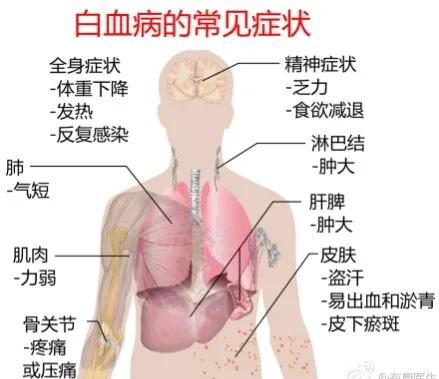 白细胞增多是病吗,白细胞增多就是白血病吗