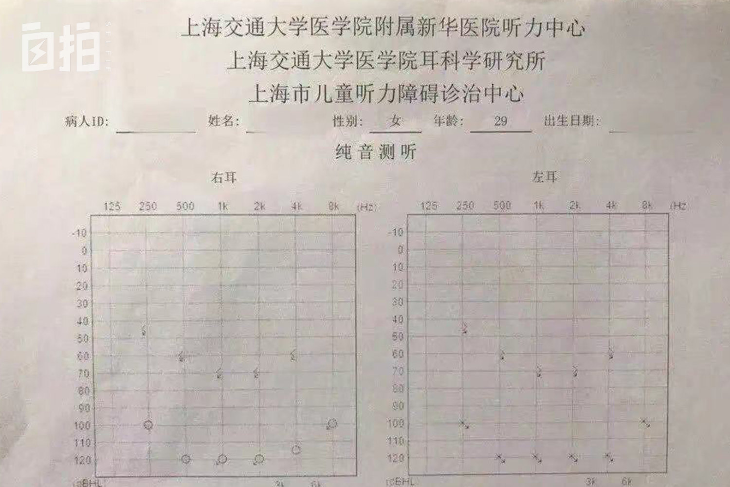 鍏堝ぉ鎬уけ鑱墜鏈垂澶氬皯,澶辫仾鎵嬫湳鎭㈠鍚姏