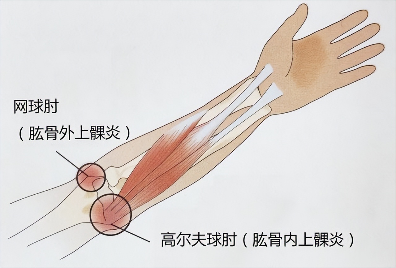 富血小板血浆因子作用,富血小板血浆治疗的目的和意义