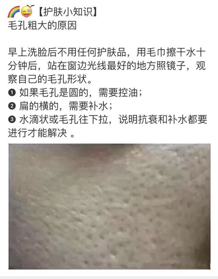 鐨偆绮楃硻鏆楁矇姣涘瓟绮楀ぇ鎬庝箞鏀瑰杽,姣涘瓟绮楀ぇ濡備綍鏀瑰杽鏈夋晥