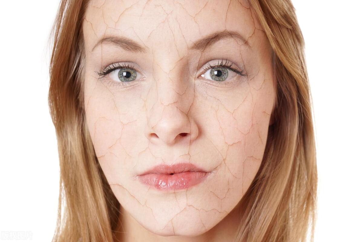 频繁洗澡后乳头破损结痂，老公轻轻摸一下都疼，这是什么病？