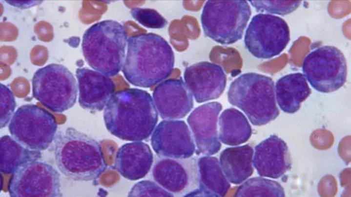 疫情期间买不到靶向药怎么办,疫情药物买不到怎么办