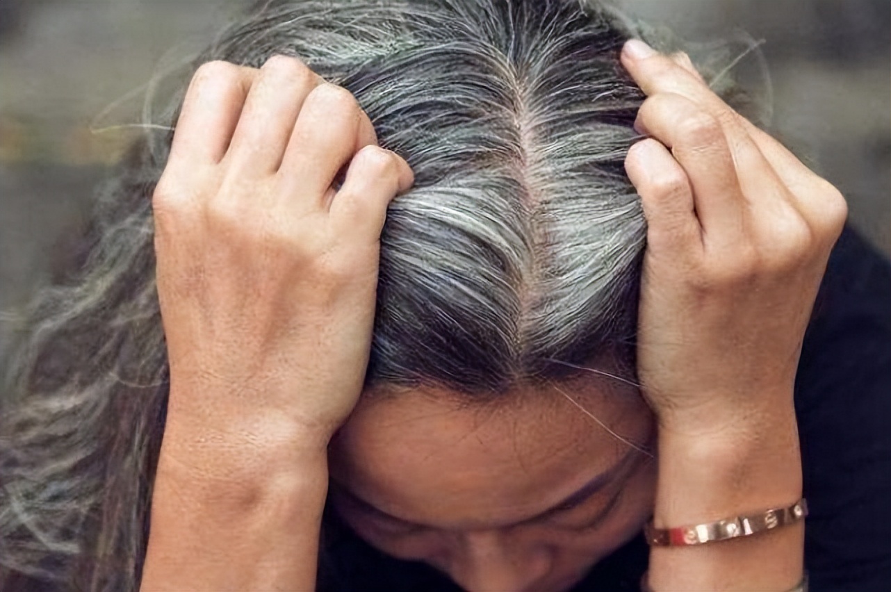 缺乏哪种维生素会导致白发问题,缺乏什么维生素会出现白发