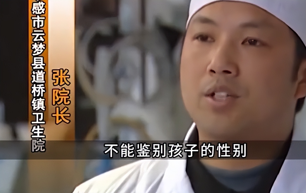 湖北女子生下连体婴儿,湖北孕妇生下首例“连体女婴”