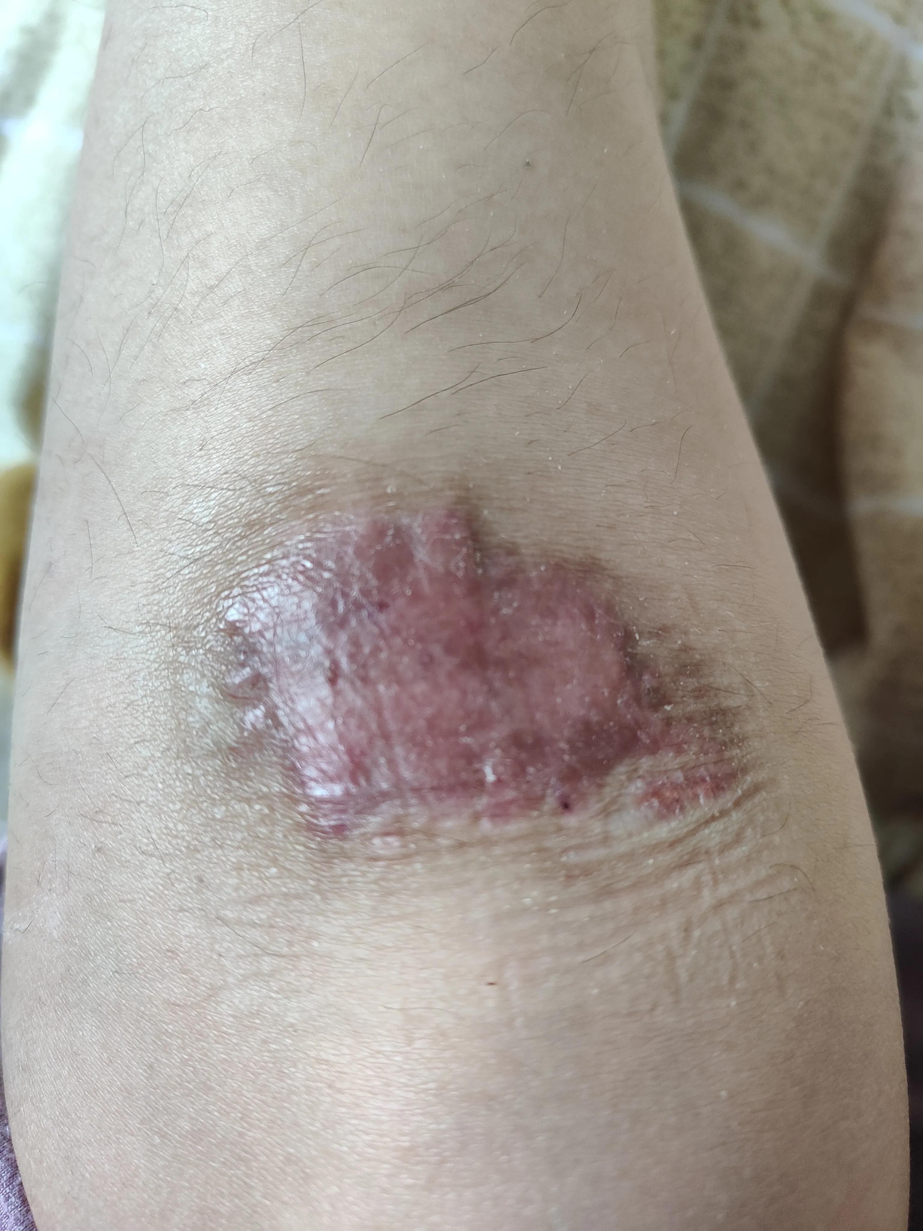 武汉同济医院骗子,武汉同济医院光谷区是高风险吗