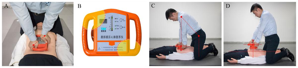 腹部提压心肺复苏术有用吗,腹部提压心肺复苏和胸外心脏按压