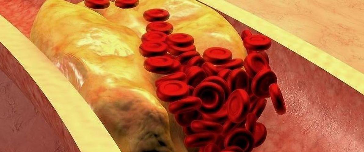 提高免疫力最好最实用的药是什么,提高免疫力的药物哪个最好最快