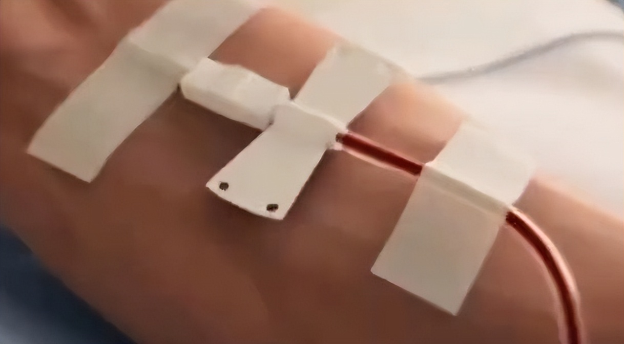 陕西宝鸡十八岁女孩稀有血型,宝鸡18岁女孩血型