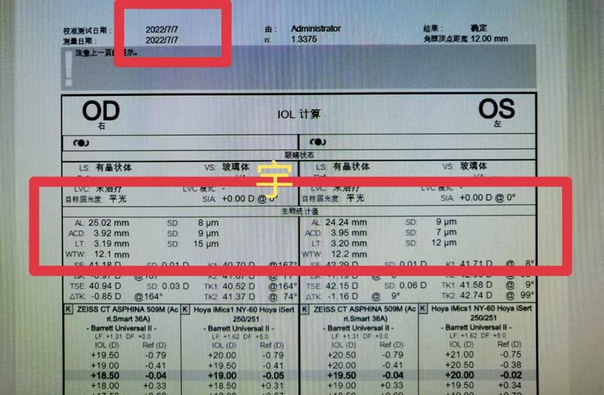 分享配眼镜案例,分享配眼镜的小知识