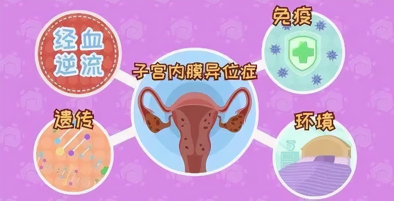 女子每月痛经,女性痛经5年加重