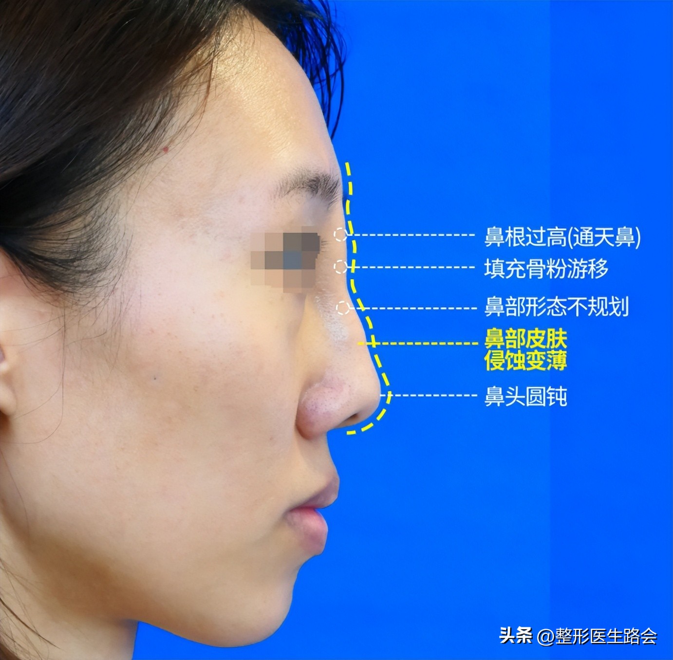 一时冲动做的决定后悔了,一时冲动做出错误的选择