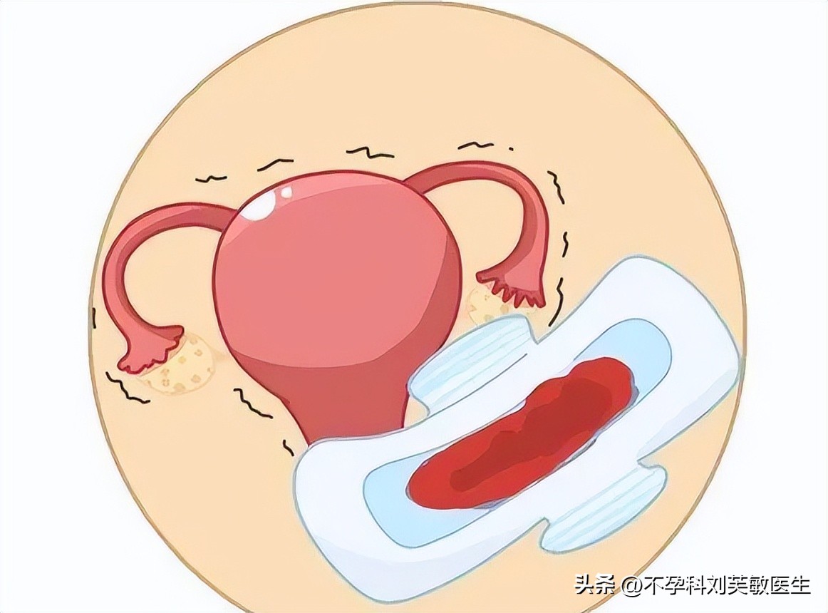 月经推迟痛经,痛经血块推迟出来