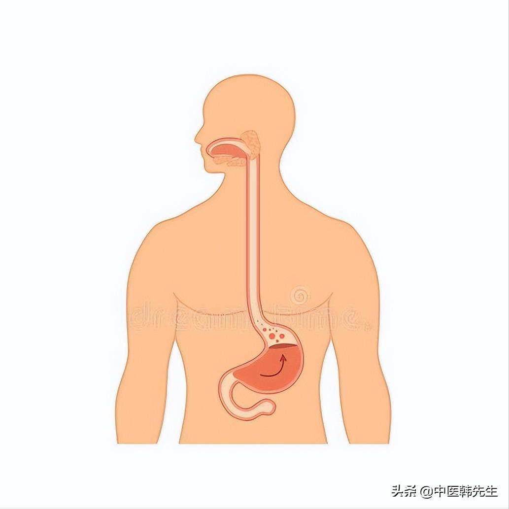 越鞠丸和四逆散治反流性食管炎,四逆散可以治疗胆汁反流性胃炎吗