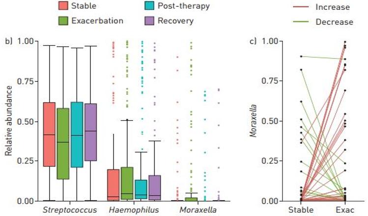周敏教授：慢阻肺病、支扩及慢阻肺支扩重叠综合征气道微生物研究