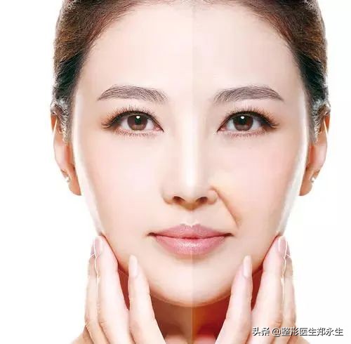 激光祛面部皱纹能保持多久,面部皱纹去除拉皮可以保持多久