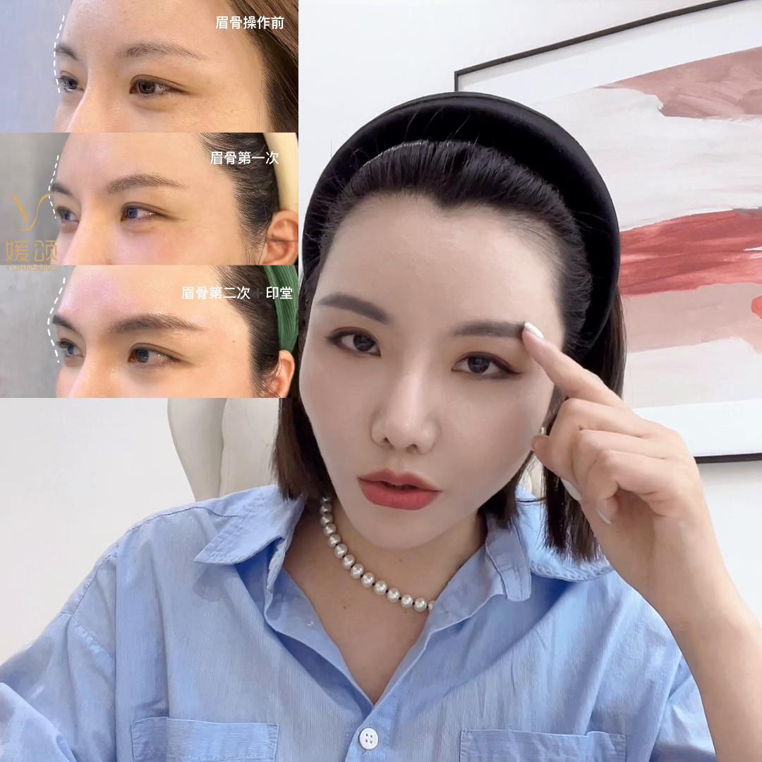 给正在做医美行业的忠告,10年前做过医美的现在怎么样了