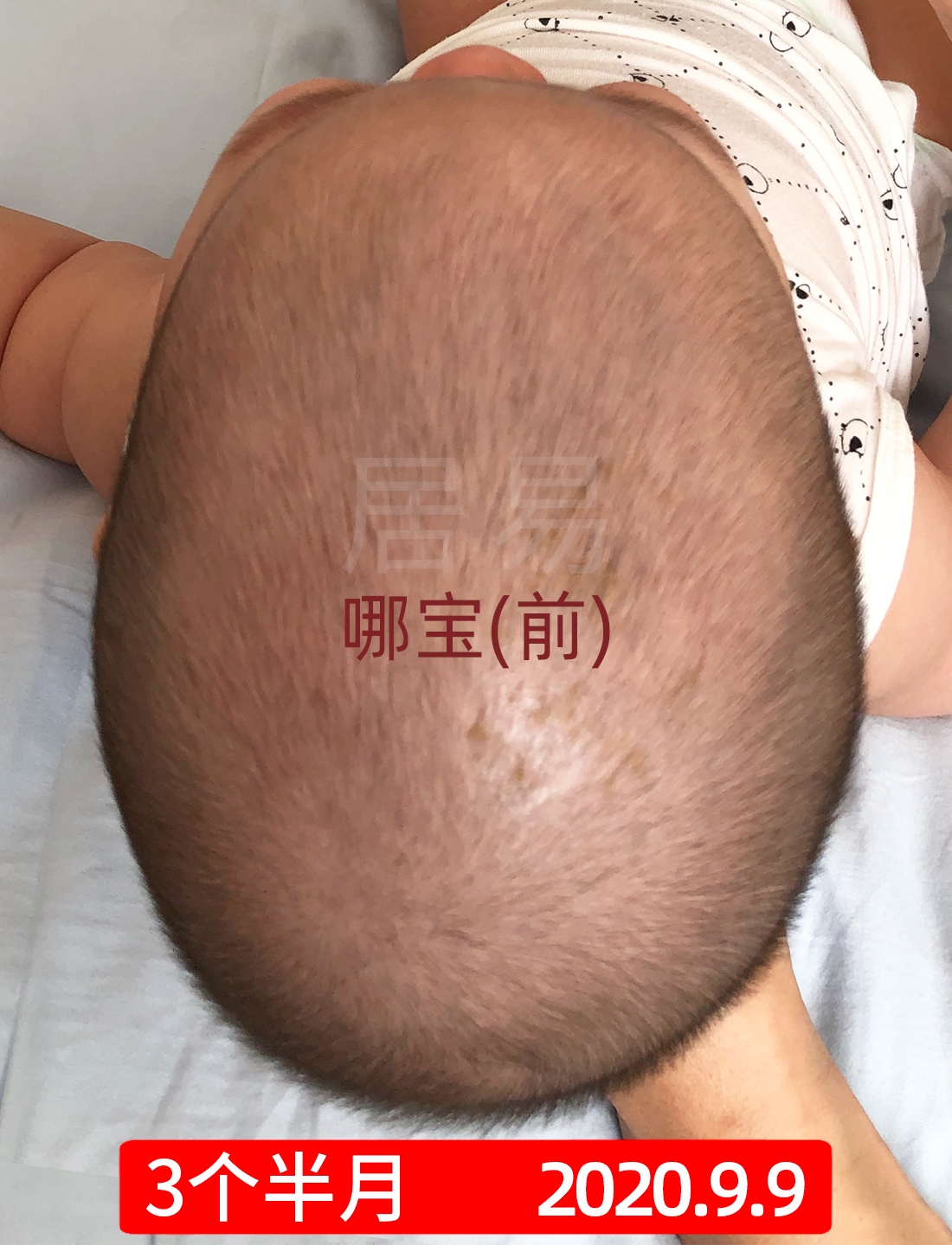 菱形头宝宝头型怎么矫正,上尖下扁头型宝宝头型怎么调整