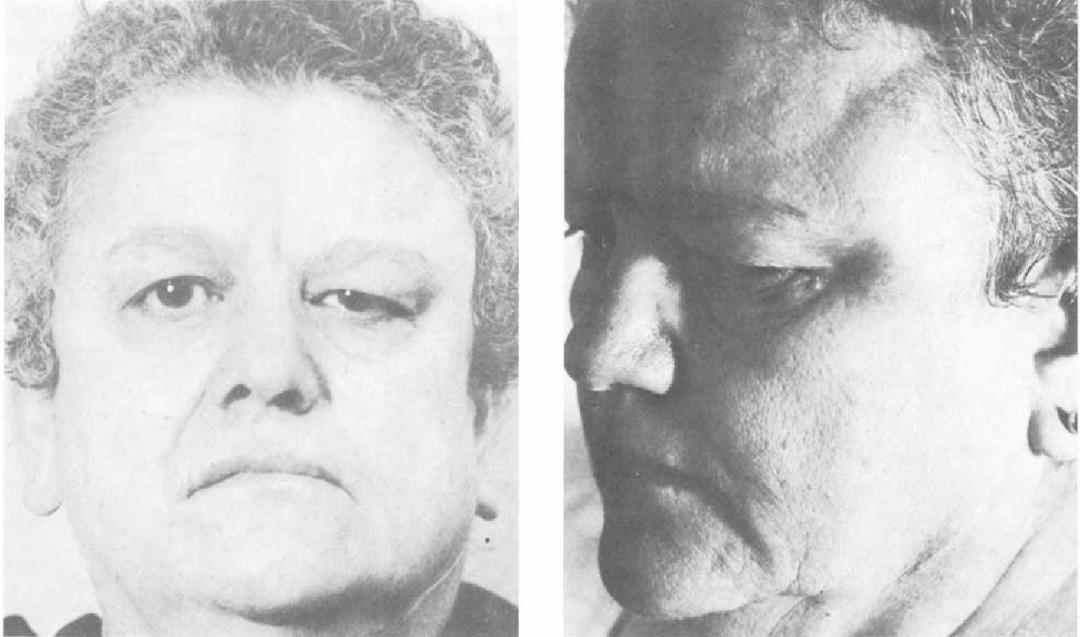 脸越来越方了是什么原因,脸部越来越方怎么回事